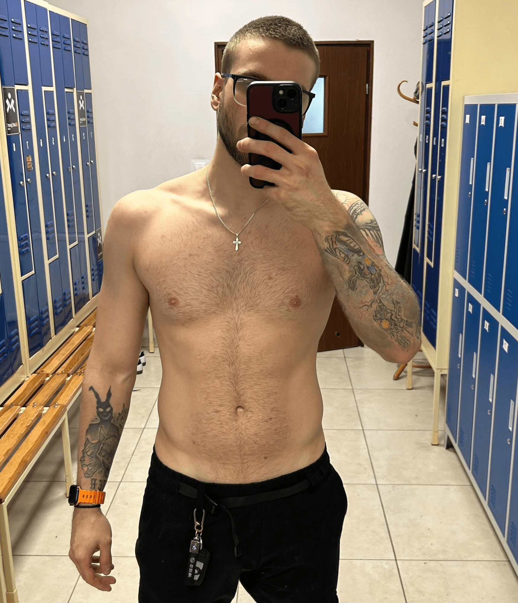 Patryk, zdjęcie przed